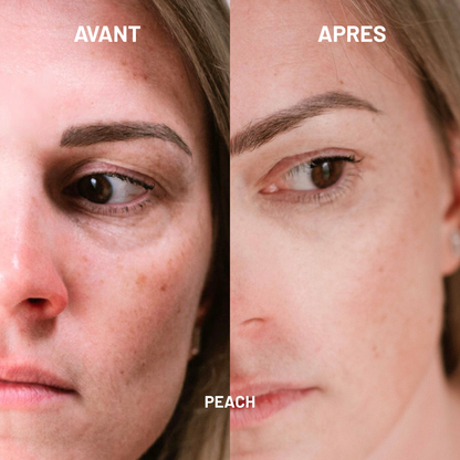 anticerne peau mature hydratant